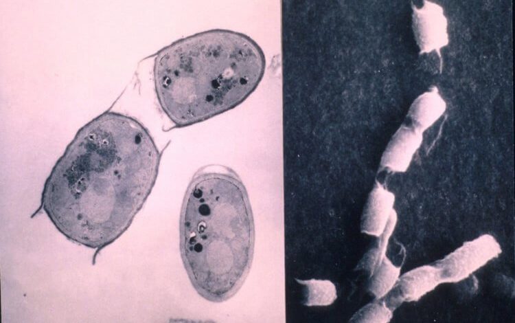 Фото - В США опасный грибок заражает человеческий мозг. Что нужно знать?